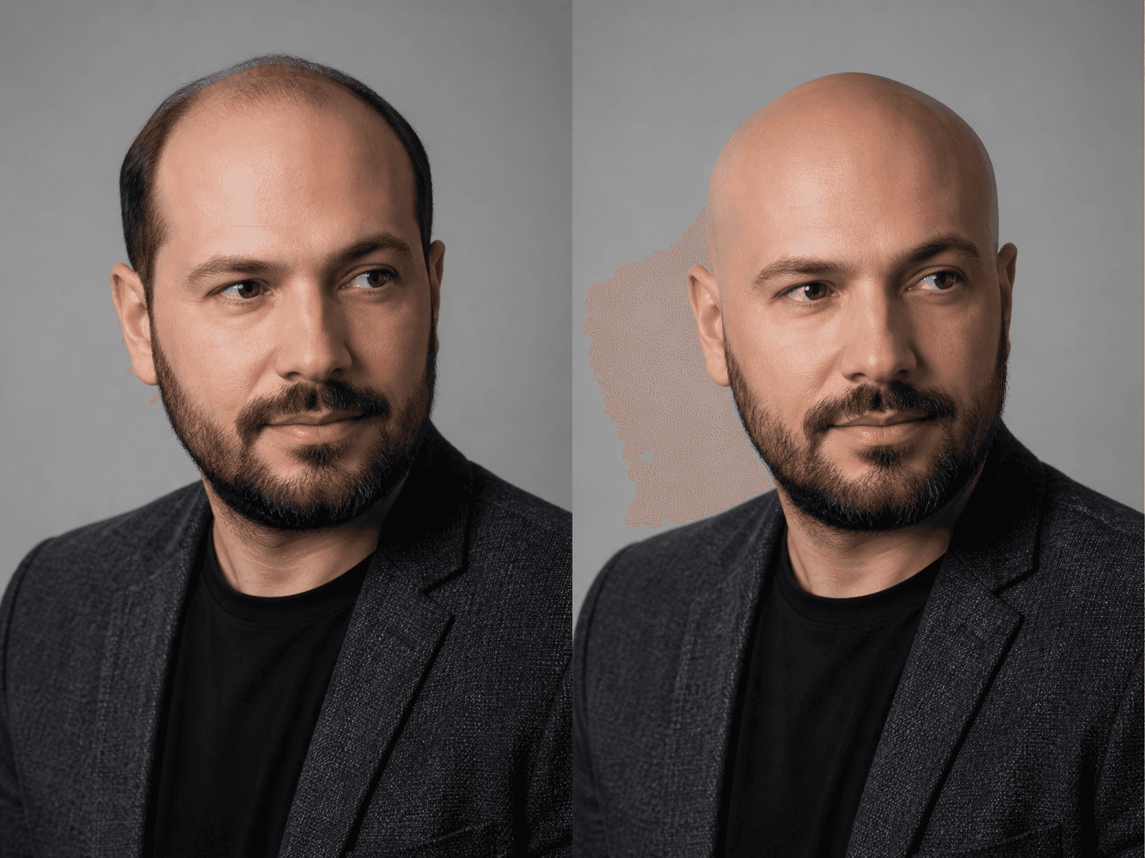 Bald Photo Edit